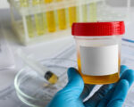 The Role of Synthetic Urine in Quick Fixes